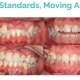 New standards, Moving ahead with Tristar! : TRISTAR-Aligner Material